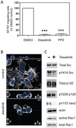 delta Catenin Antibody in Western Blot (WB)