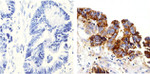 delta Catenin Antibody in Immunohistochemistry (Paraffin) (IHC (P))