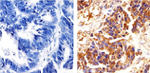 delta Catenin Antibody in Immunohistochemistry (Paraffin) (IHC (P))