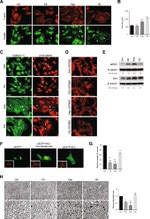 delta Catenin Antibody in Immunocytochemistry (ICC/IF)