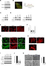 delta Catenin Antibody in Immunocytochemistry (ICC/IF)