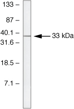 SOCS2 Antibody in Western Blot (WB)