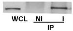 ch-TOG Antibody in Immunoprecipitation (IP)