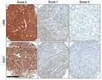 ROR2 Antibody in Immunohistochemistry (Paraffin) (IHC (P))