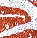 KBA.62 (Melanoma Associated Antigen) Antibody in Immunohistochemistry (Paraffin) (IHC (P))