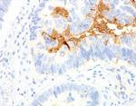 TAG-72 Antibody in Immunohistochemistry (Paraffin) (IHC (P))