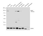 NEFM Antibody in Western Blot (WB)