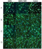 ZO-1 Antibody in Immunocytochemistry (ICC/IF)