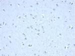 IDH1-R132H (Isocitrate Dehydrogenase) Antibody in Immunohistochemistry (Paraffin) (IHC (P))