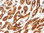 IDH1-R132H (Isocitrate Dehydrogenase) Antibody in Immunohistochemistry (Paraffin) (IHC (P))