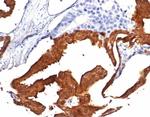 IDH1-R132H (Isocitrate Dehydrogenase) Antibody in Immunohistochemistry (Paraffin) (IHC (P))