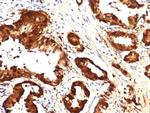 IDH1-R132H (Isocitrate Dehydrogenase) Antibody in Immunohistochemistry (Paraffin) (IHC (P))