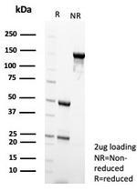 IDH1-R132H (Isocitrate Dehydrogenase) Antibody in SDS-PAGE (SDS-PAGE)