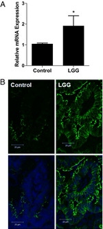 Claudin 3 Antibody in Immunohistochemistry (IHC)