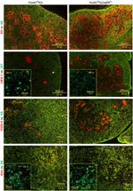 Claudin 3 Antibody in Immunohistochemistry (IHC)