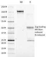 Interferon alpha-1 (IFNA1) Antibody in SDS-PAGE (SDS-PAGE)