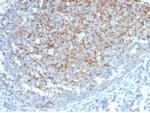 Interferon alpha Antibody in Immunohistochemistry (Paraffin) (IHC (P))