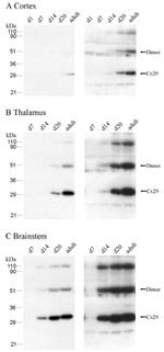 Connexin 29 Antibody in Western Blot (WB)