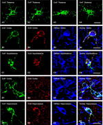 Connexin 32 Antibody in Immunocytochemistry (ICC/IF)