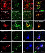 Connexin 32 Antibody in Immunocytochemistry (ICC/IF)