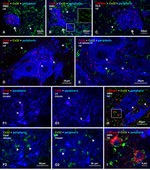 Connexin 36 Antibody in Immunohistochemistry (IHC)