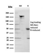 Apolipoprotein D/APOD Antibody in SDS-PAGE (SDS-PAGE)