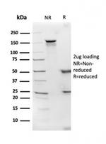 Apolipoprotein D/APOD Antibody in SDS-PAGE (SDS-PAGE)
