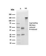 Apolipoprotein D/APO-D Antibody in Immunoelectrophoresis (IE)