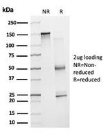 ZNF81/Zinc finger protein 81 (Transcription Factor) Antibody in SDS-PAGE (SDS-PAGE)