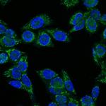 Insulin-like Growth Factor-1 (IGF-1) Antibody in Immunocytochemistry (ICC/IF)