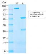 Insulin-like Growth Factor-1 (IGF-1) Antibody in SDS-PAGE (SDS-PAGE)