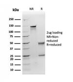 Apolipoprotein E/APOE Antibody in SDS-PAGE (SDS-PAGE)