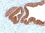 IGF1R/CD221 Antibody in Immunoelectrophoresis (IE)