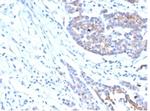 IGF1R/CD221 Antibody in Immunohistochemistry (Paraffin) (IHC (P))