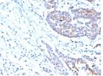 IGF1R/CD221 Antibody in Immunohistochemistry (Paraffin) (IHC (P))