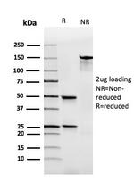 Immunoglobulin Alpha (IgA) Heavy Chain Antibody in SDS-PAGE (SDS-PAGE)