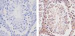 TBX1 Antibody in Immunohistochemistry (Paraffin) (IHC (P))