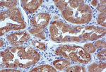 Ezrin Antibody in Immunohistochemistry (IHC)