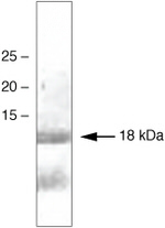 alpha Synuclein Antibody in Western Blot (WB)