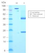 IgM (Immunoglobulin Mu Heavy Chain) Antibody in SDS-PAGE (SDS-PAGE)