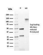 Kappa Light Chain/IGKC Antibody in SDS-PAGE (SDS-PAGE)