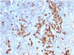 Kappa Light Chain/IGKC Antibody in Immunohistochemistry (Paraffin) (IHC (P))