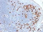 Kappa Light Chain Antibody in Immunohistochemistry (Paraffin) (IHC (P))