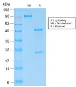 Kappa Light Chain/IGKC Antibody in SDS-PAGE (SDS-PAGE)