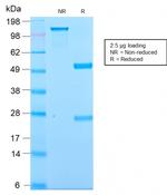 Kappa Light Chain/IGKC (B-Cell Marker) Antibody in SDS-PAGE (SDS-PAGE)