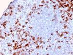 Kappa Light Chain/IGKC (B-Cell Marker) Antibody in Immunohistochemistry (Paraffin) (IHC (P))