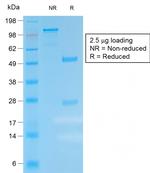 Kappa Light Chain Antibody in SDS-PAGE (SDS-PAGE)