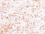 Lambda Light Chain Antibody in Immunohistochemistry (Paraffin) (IHC (P))