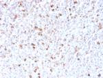 Lambda Light Chain Antibody in Immunohistochemistry (Paraffin) (IHC (P))