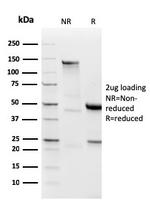 Lambda Light Chain Antibody in SDS-PAGE (SDS-PAGE)